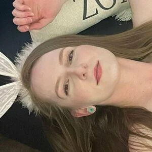 myskyewatson