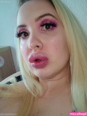 Vivian_Rose [ vivian-rose ] - Doing face blurring in pics till February or whenever my swelling