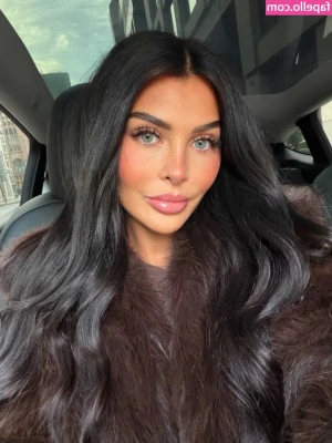 Lisa del Piero [ lisa-del-piero-1 ] - I'm getting my lips done in 8 days... Can you help me out?  Get