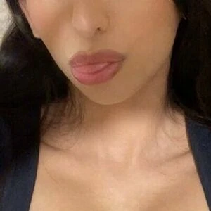 servesyra