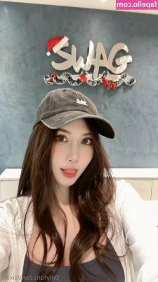aixibb - My face is healing up very nicely though, I think in a month or two I
