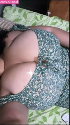 Kelly Del Rey [ kelly-del-rey ] - AHHH GUYS MY SURGERY SCARS ARE ALMOST ALL GONE OMG
