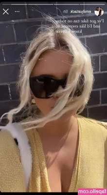 Emily Atack [ emily-atack ] - Got a spray tan today for a wedding I’m going to tomorrow 👀🤝