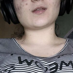 twinkydionefree