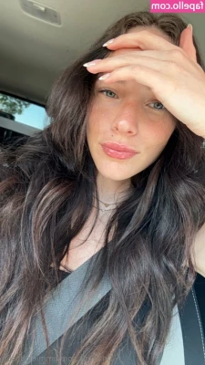 emmiejohnson - idk whats going on w my face but swipe to see it all off    i noticed