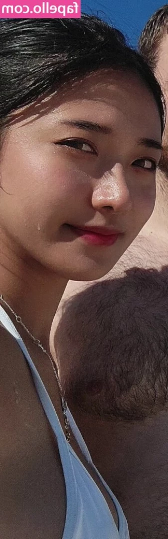 jinnytty [ jinnytty-1 ] - Have you gotten a sunburn this summer yet?