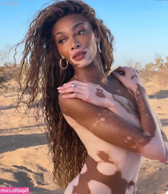 Winnie Harlow [ winnie-harlow ] - Just a few of our bloopers! We had a right laugh that week! 😂