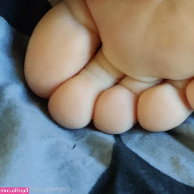 feet-amana - Had a few hours without hives today! Woot woot hopefully this means