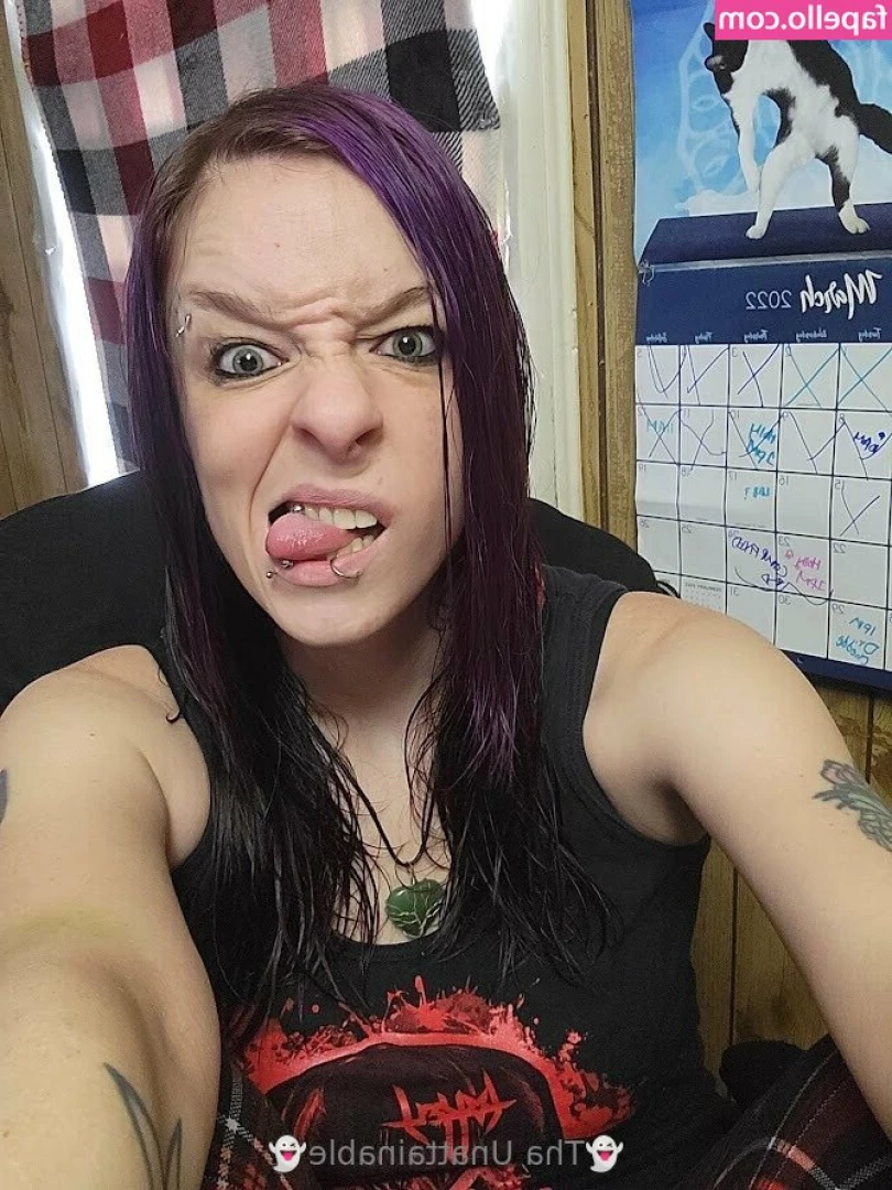 thaunattainable - my beautiful surgery scars  message me what you wanna see