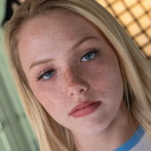 Pale Freckled Girls