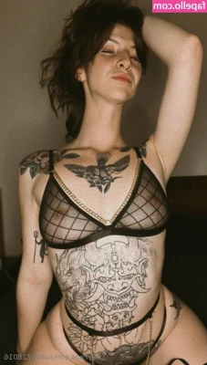 u448728016 - Surgery can t stop me
