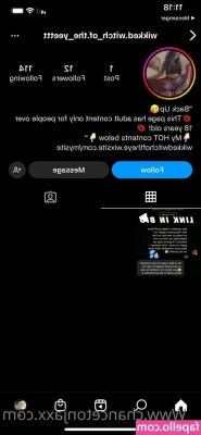 chancetonjaxx - I warn you  Sore dick is one of the SYMPTOMS