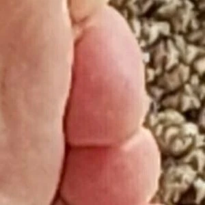 brattypuppybite