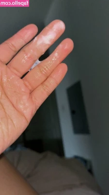 Creamy Pussies [ creamy-pussies-5 ] - One week post-op   First day back at work today was better than